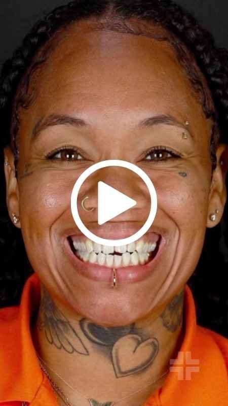 Implant journey