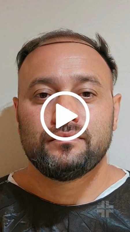 My transplant journey