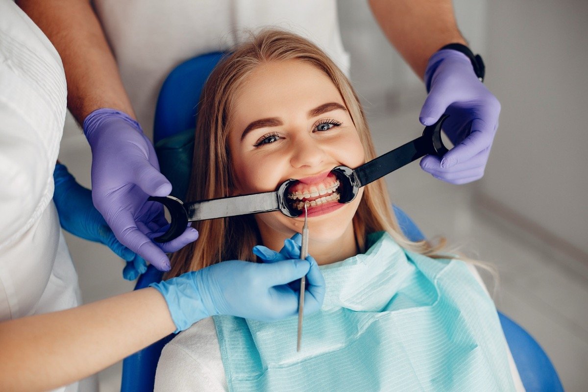 Dental Veneers