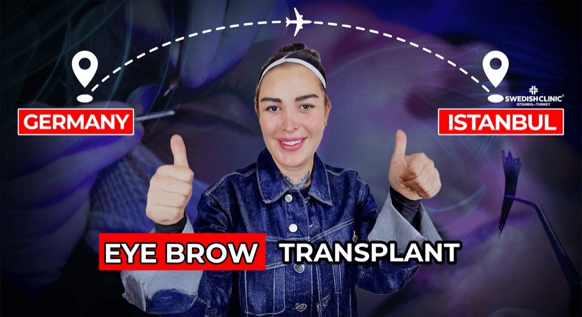 Eyebrow Transplant
