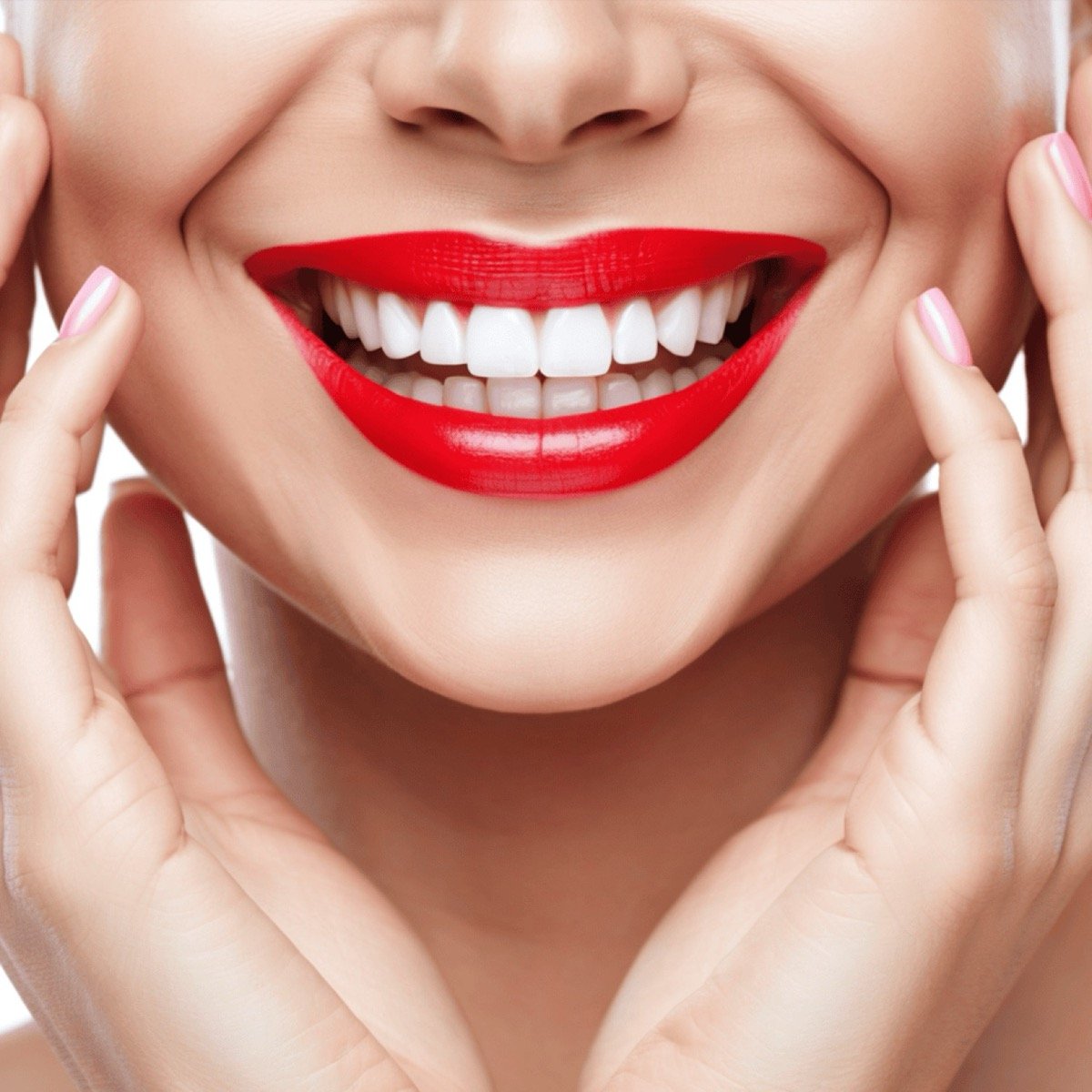 Hollywood Smile
